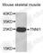 Troponin I1, Slow Skeletal Type antibody, A4161, ABclonal Technology, Western Blot image 