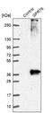 G Protein-Coupled Receptor 78 antibody, NBP1-86467, Novus Biologicals, Western Blot image 