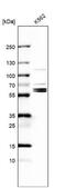 Ro60, Y RNA Binding Protein antibody, NBP1-86998, Novus Biologicals, Western Blot image 
