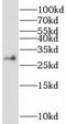 SRP Receptor Subunit Beta antibody, FNab08239, FineTest, Western Blot image 