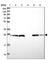 NAD(P)HX Epimerase antibody, HPA048164, Atlas Antibodies, Western Blot image 