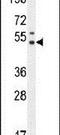 Pseudouridine Synthase 3 antibody, PA5-24321, Invitrogen Antibodies, Western Blot image 