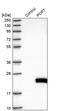 POP7 Homolog, Ribonuclease P/MRP Subunit antibody, PA5-54305, Invitrogen Antibodies, Western Blot image 