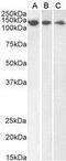 Damage Specific DNA Binding Protein 1 antibody, GTX89975, GeneTex, Western Blot image 