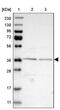 Elongator Acetyltransferase Complex Subunit 5 antibody, PA5-54745, Invitrogen Antibodies, Western Blot image 
