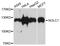 Nucleolar And Coiled-Body Phosphoprotein 1 antibody, STJ111255, St John