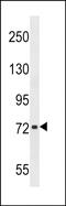 Chondroadherin Like antibody, PA5-48781, Invitrogen Antibodies, Western Blot image 