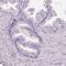 Hydroxysteroid 17-Beta Dehydrogenase 1 antibody, HPA065296, Atlas Antibodies, Immunohistochemistry paraffin image 