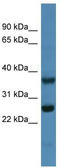 ATP Synthase Peripheral Stalk-Membrane Subunit B antibody, TA346560, Origene, Western Blot image 