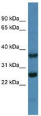 ATP synthase subunit b, mitochondrial antibody, TA346560, Origene, Western Blot image 