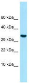 Inhibin Subunit Beta C antibody, TA338148, Origene, Western Blot image 