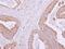 G Protein Subunit Alpha O1 antibody, PA5-30044, Invitrogen Antibodies, Immunohistochemistry paraffin image 
