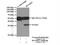 Deoxyribonuclease 2, Lysosomal antibody, 15934-1-AP, Proteintech Group, Immunoprecipitation image 