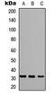 Growth Factor Receptor Bound Protein 2 antibody, LS-C358763, Lifespan Biosciences, Western Blot image 