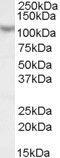 Mastermind Like Transcriptional Coactivator 1 antibody, GTX17019, GeneTex, Western Blot image 