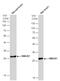 High Mobility Group Box 1 antibody, GTX629445, GeneTex, Western Blot image 