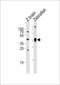 Adenosine Deaminase antibody, LS-C344697, Lifespan Biosciences, Western Blot image 