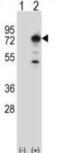 Protein Phosphatase With EF-Hand Domain 1 antibody, abx028028, Abbexa, Western Blot image 