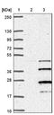 Transmembrane Protein 208 antibody, NBP1-92518, Novus Biologicals, Western Blot image 