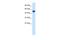 SET Domain Containing 4 antibody, A14445, Boster Biological Technology, Western Blot image 