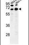 Bestrophin 2 antibody, PA5-26253, Invitrogen Antibodies, Western Blot image 