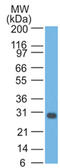 Bcl-XS antibody, AM50202PU-S, Origene, Western Blot image 