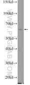 CCR4-NOT Transcription Complex Subunit 2 antibody, 10313-1-AP, Proteintech Group, Western Blot image 