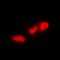 Ribosomal Protein S6 Kinase B1 antibody, LS-C352837, Lifespan Biosciences, Immunofluorescence image 