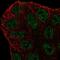 ATP Binding Cassette Subfamily A Member 6 antibody, NBP2-57372, Novus Biologicals, Immunofluorescence image 