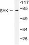 Spleen Associated Tyrosine Kinase antibody, LS-C176227, Lifespan Biosciences, Western Blot image 