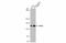 SIN3 Transcription Regulator Family Member A antibody, GTX129156, GeneTex, Western Blot image 