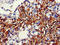 Acyl-CoA Dehydrogenase Short/Branched Chain antibody, LS-C682149, Lifespan Biosciences, Immunohistochemistry paraffin image 
