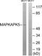 MAPK Activated Protein Kinase 5 antibody, TA314770, Origene, Western Blot image 