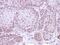 Death Domain Associated Protein antibody, PA5-29592, Invitrogen Antibodies, Immunohistochemistry paraffin image 