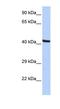 Kaptin, Actin Binding Protein antibody, NBP1-55221, Novus Biologicals, Western Blot image 