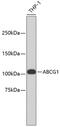 ATP Binding Cassette Subfamily G Member 1 antibody, 13-977, ProSci, Western Blot image 