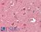 Ras Homolog, MTORC1 Binding antibody, LS-B12851, Lifespan Biosciences, Immunohistochemistry paraffin image 