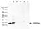 Histone Cluster 1 H2A Family Member M antibody, NBP2-59261, Novus Biologicals, Western Blot image 