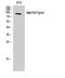 MER Proto-Oncogene, Tyrosine Kinase antibody, A00489-1, Boster Biological Technology, Western Blot image 