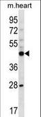 Phosphorylase Kinase Catalytic Subunit Gamma 2 antibody, LS-C164528, Lifespan Biosciences, Western Blot image 