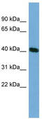 Testis Specific Serine Kinase 2 antibody, TA335414, Origene, Western Blot image 