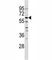 NMB antibody, F45454-0.4ML, NSJ Bioreagents, Western Blot image 