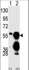 Protein phosphatase 1F antibody, LS-C101052, Lifespan Biosciences, Western Blot image 