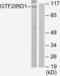 GTF2I Repeat Domain Containing 1 antibody, LS-C119311, Lifespan Biosciences, Western Blot image 