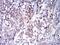CD79a antibody, NBP2-61794, Novus Biologicals, Immunohistochemistry paraffin image 
