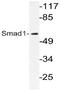 SMAD Family Member 1 antibody, AP21086PU-N, Origene, Western Blot image 