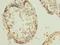 RB Binding Protein 9, Serine Hydrolase antibody, LS-C376437, Lifespan Biosciences, Immunohistochemistry paraffin image 