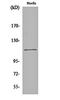SUMO Specific Peptidase 7 antibody, orb162730, Biorbyt, Western Blot image 