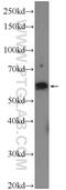 Coronin 6 antibody, 17243-1-AP, Proteintech Group, Western Blot image 