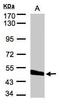 Carboxypeptidase Vitellogenic Like antibody, GTX106020, GeneTex, Western Blot image 